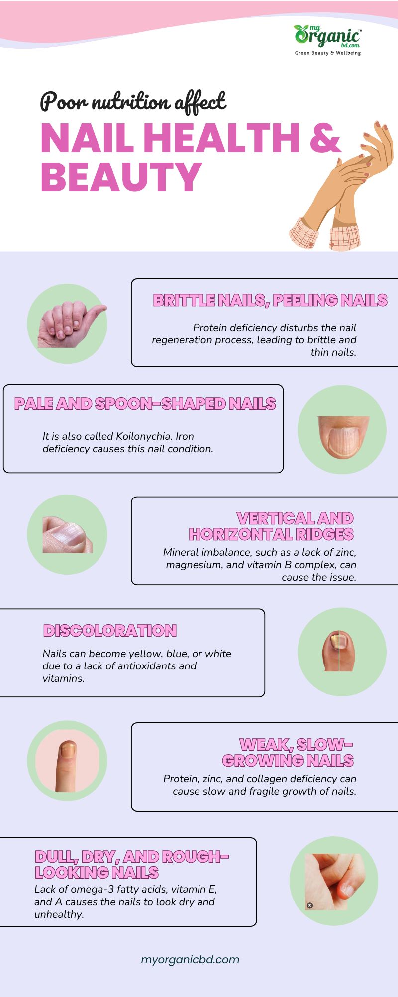 How Does Poor Nutrition Affect Nail Health &Amp; Beauty? Common Issues